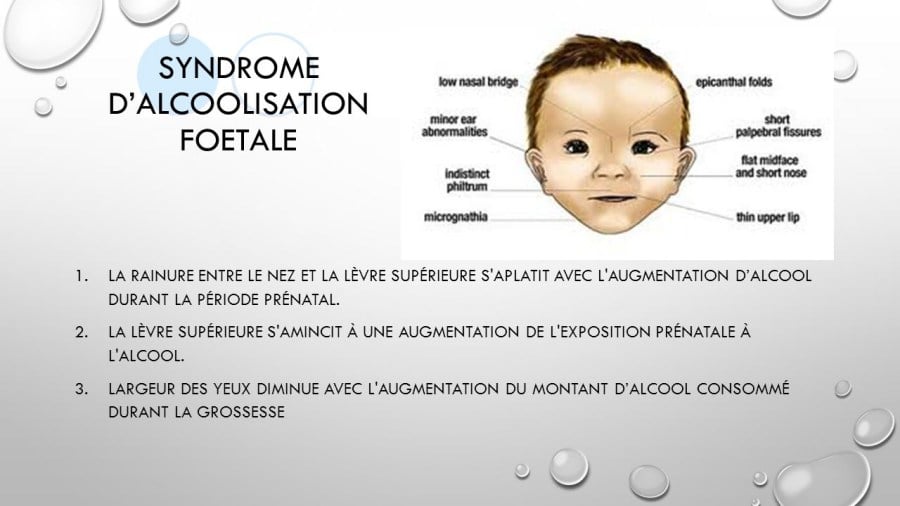 Le Syndrome Dalcoolisation Fœtale Saf Côtébébé 